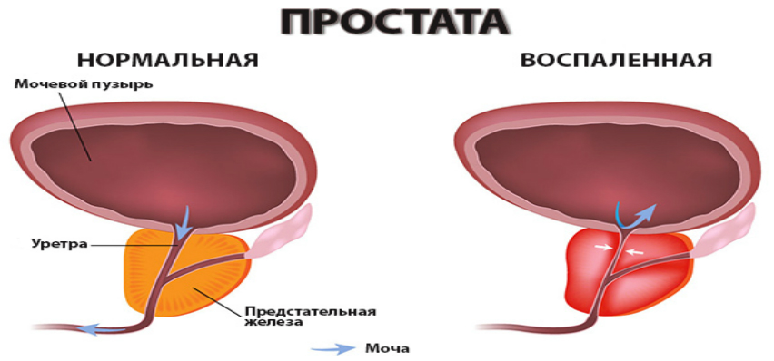 Предстательная железа строение