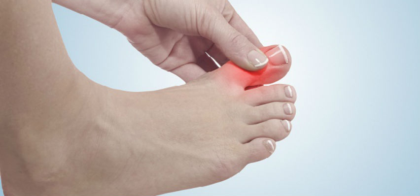 Почему болит большой палец на ноге у женщин: основные причины и лечение