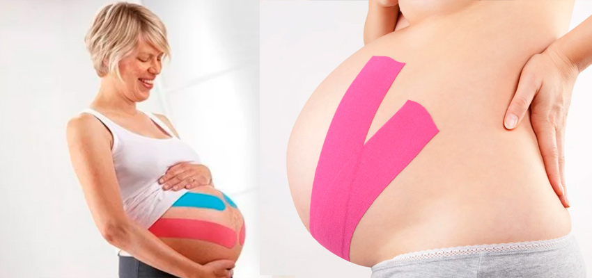 кинезиотейп-в-период-беременности.jpg