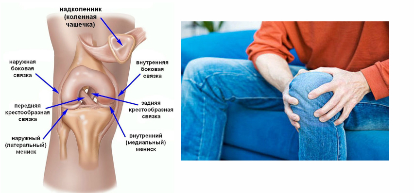 Колено болит с внутренней. Боль под чашечкой колена. Боли в колене под коленной чашечкой. Болит под коленной чашкой. Боль ниже коленной чашечки.