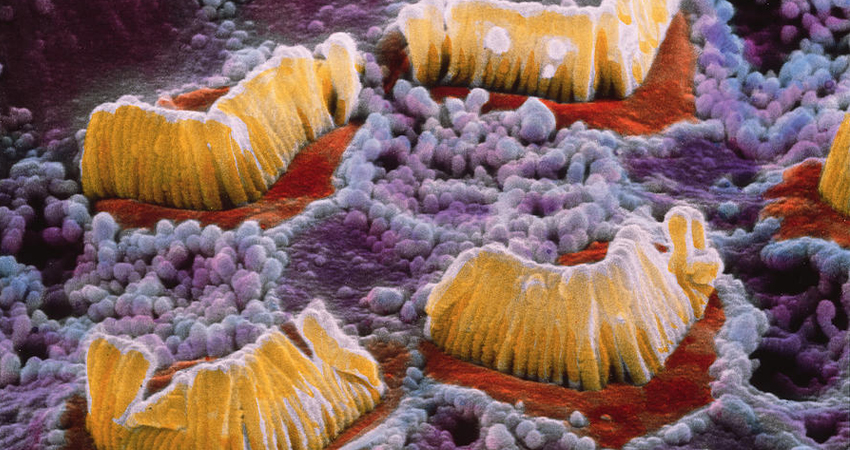 волосковые клетки внутреннего уха.jpg