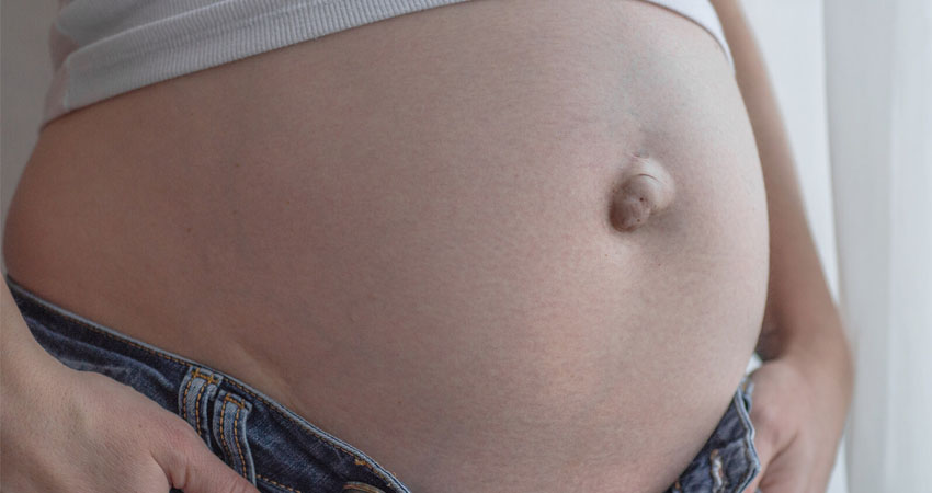 беременные с пупочной грыжей.jpg