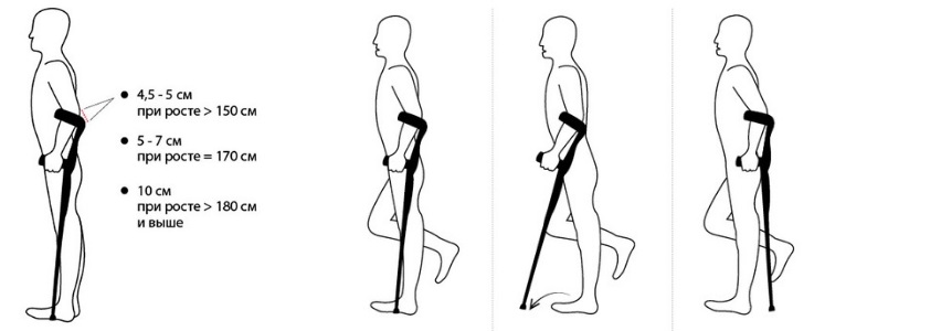 Как ходить с локтевым костылем. Костыли amfc11. Костыль с опорой под локоть схема. Как урегулировать костыли под рот. Размерная таблица для локтевых костылей.