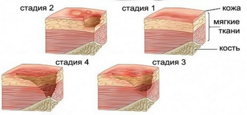 Vse Chto Vy Hoteli Znat O Prolezhnyah