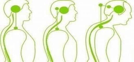 Как шейный остеохондроз воздействует на самочувствие и здоровье человека?