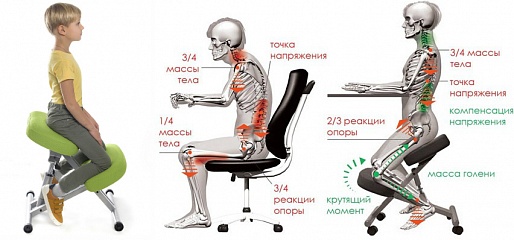  Ортопедический коленный стул: зачем он нужен?
